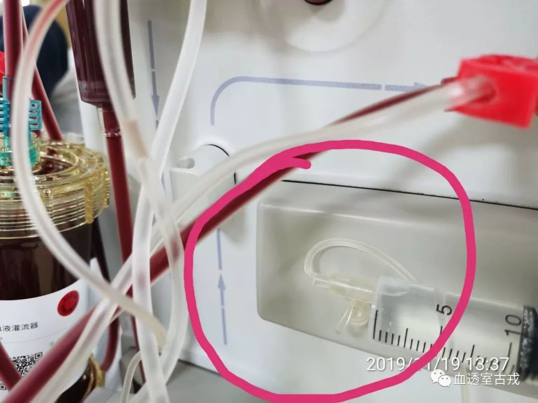 2019年血液透析护理的所获所思