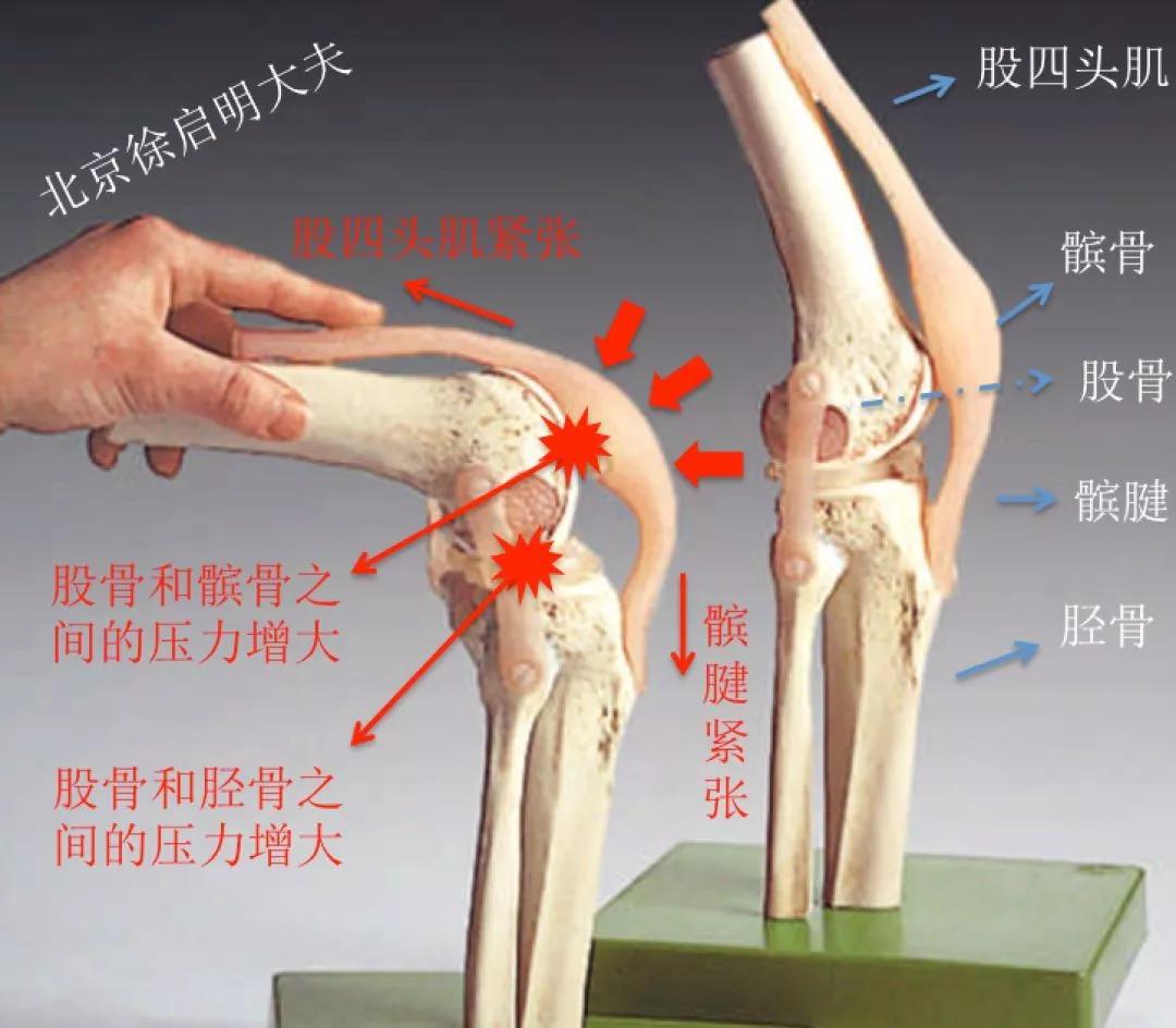左腿膝盖图片结构图图片