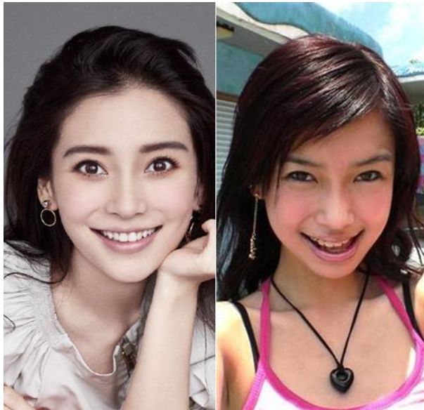 明星整牙像毁容?热巴嘴型变大杨颖太假,只有何炅最成功_baby