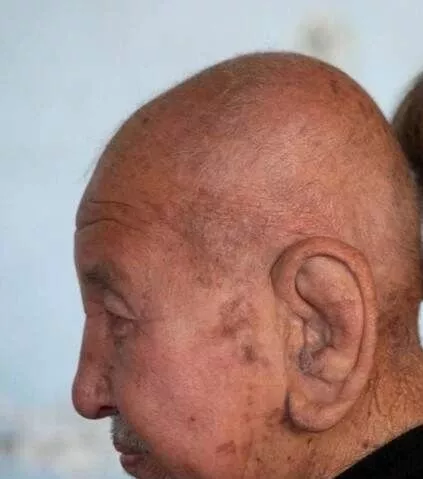 老人临终耳朵的变化图图片