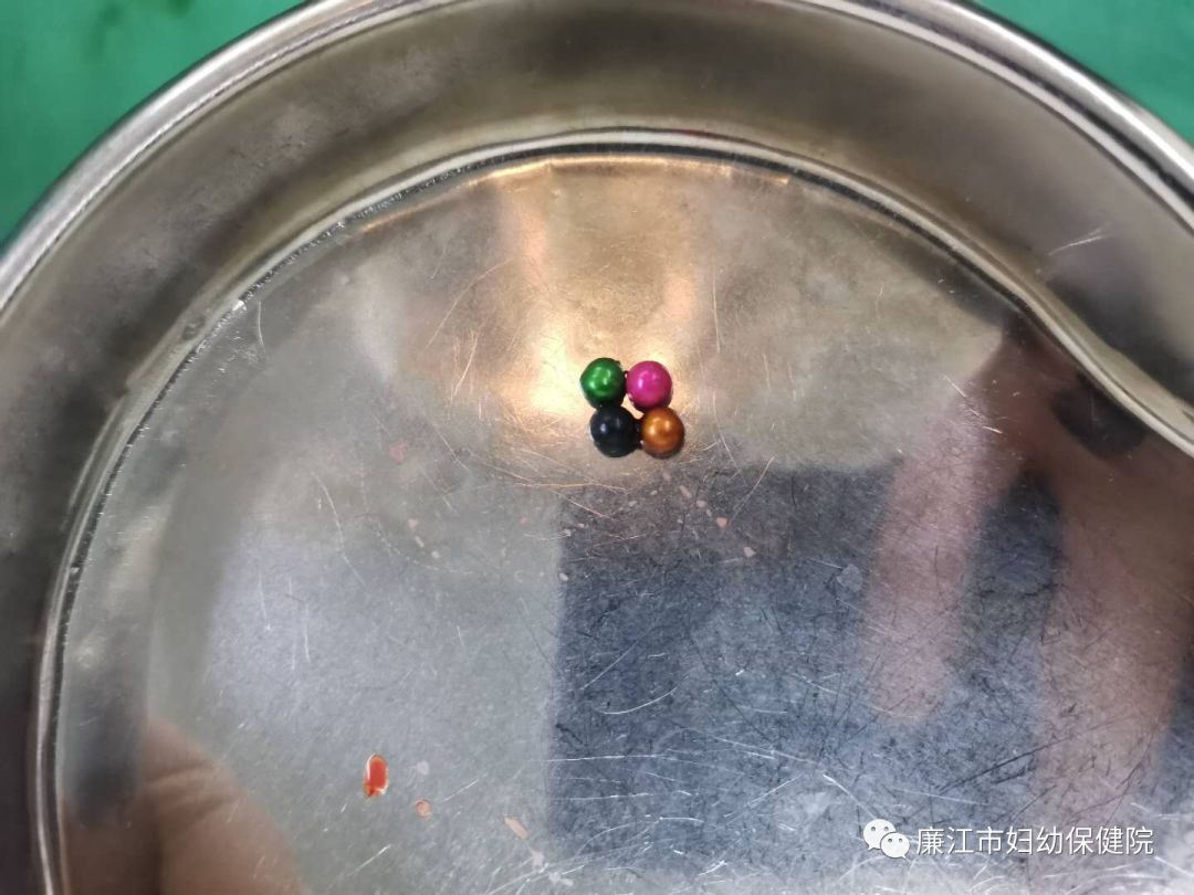 小孩误吞金属会排出吗=小孩误吞金属会排出吗?