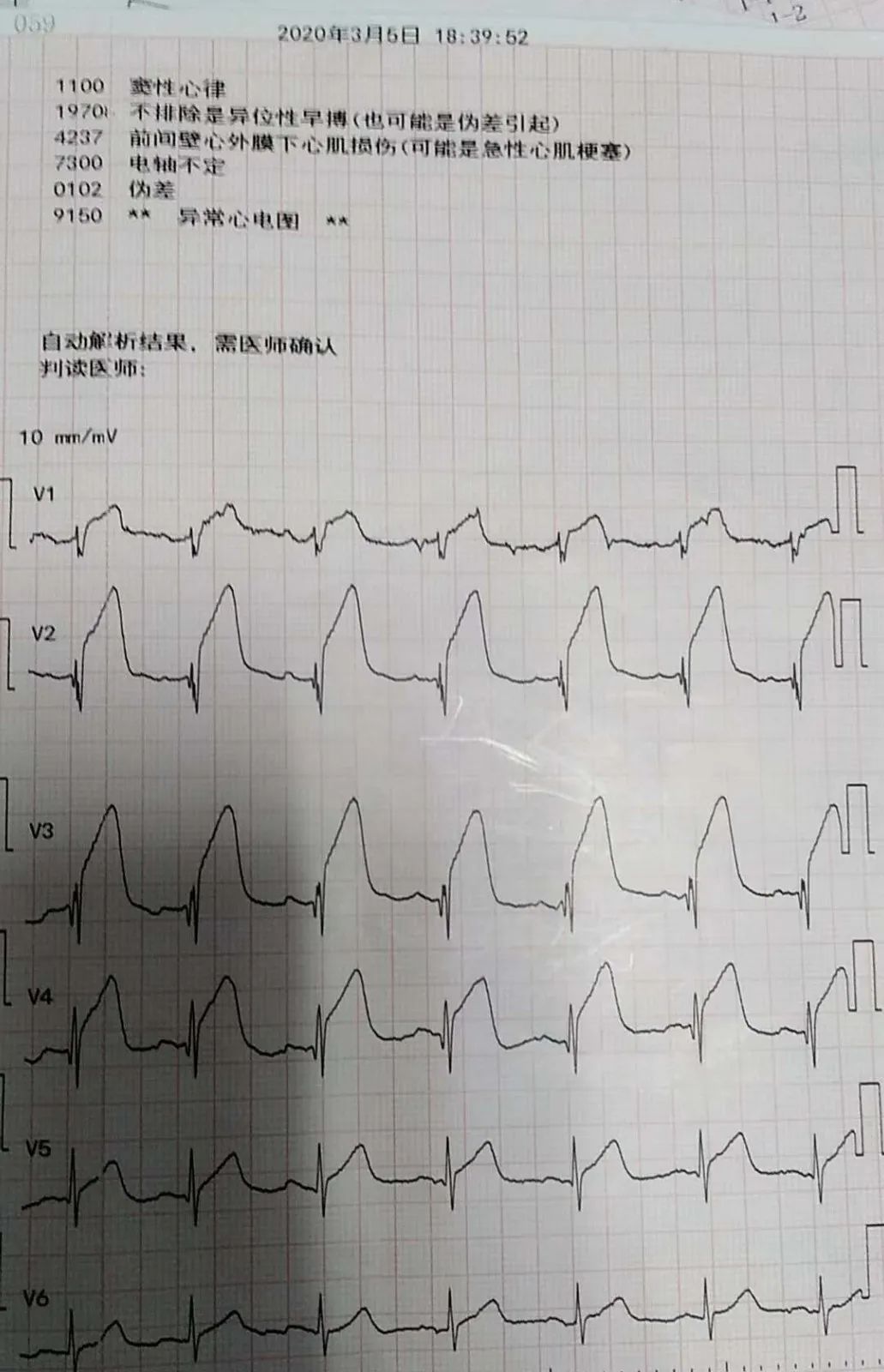 墓碑心电图图片