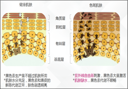 经验教程子霖老师：色斑、暗黄、痘印皮肤的特征