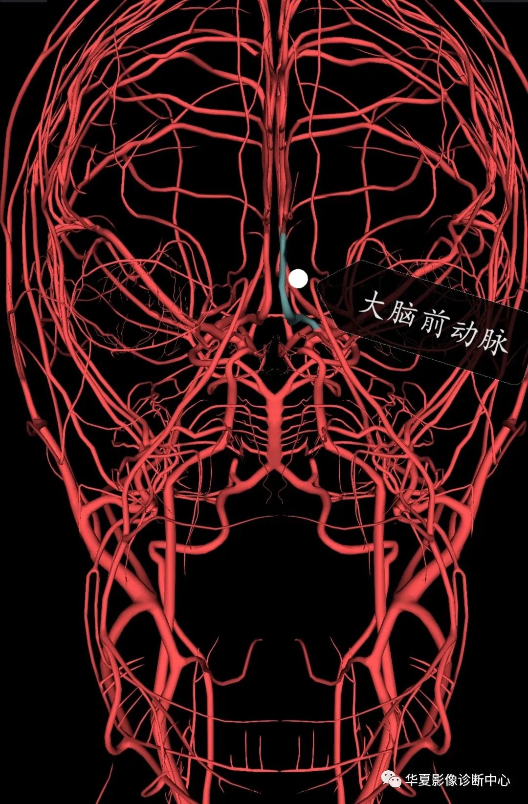 减影血管造影(dsa)下,头部二三级动脉血管解剖影像(下载保存)