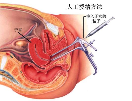 合法开展人类辅助生殖技术的单位,科室技术力量雄厚,开展精液常规检测