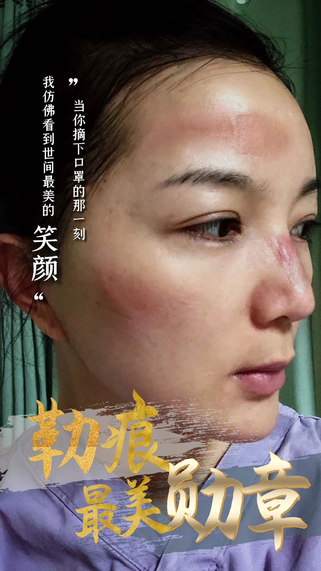 她们是我们心中最美的"战疫"女神她们在这场战疫前线绽放女性芳华也是