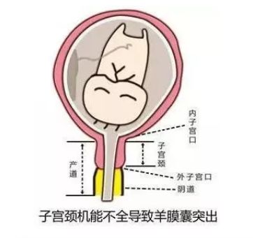 苦命女子啊……_宫颈