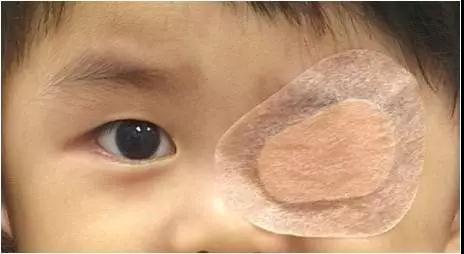 远视,散光,屈光参差,斜视,弱视2-3岁第二个关键期平时如果发现新生儿