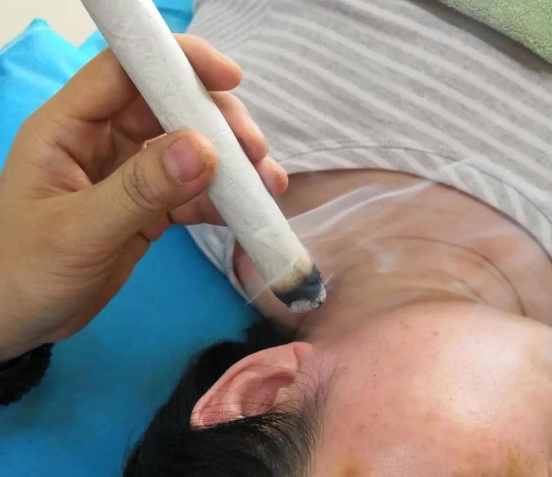 【医文医话】针灸科:防治耳聋 中医有方_治疗