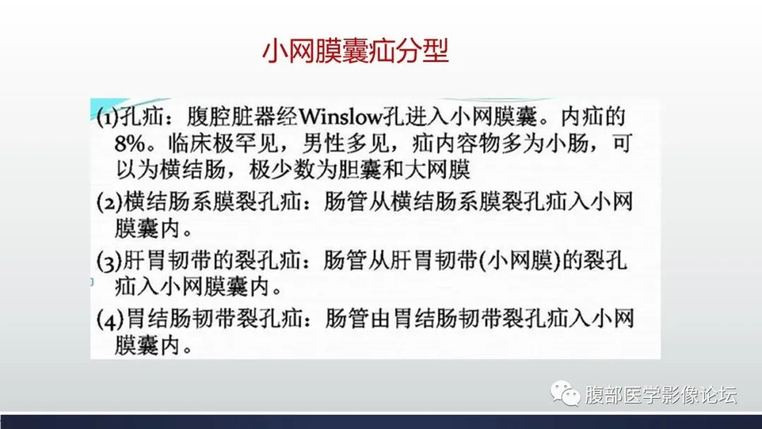 或漩渦徵(腸繫膜及血管牽拉,糾集,移位並充血水腫)絞窄性小腸梗阻徵象