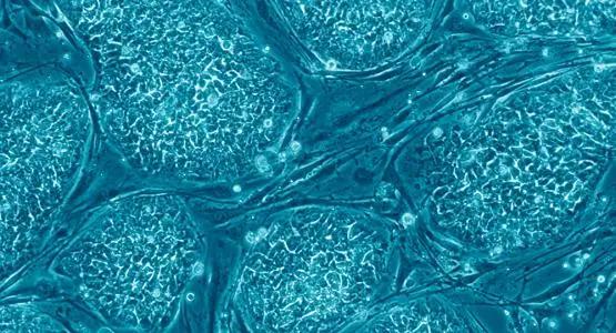 干细胞不仅在新冠，也正在改变罕见病的治疗格局