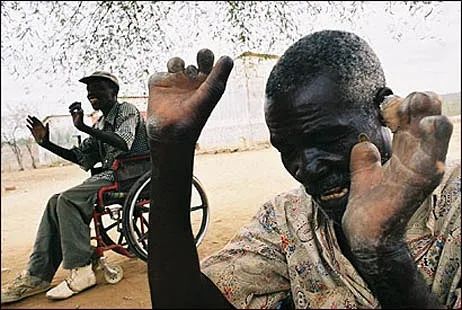 在德国,麻疯病也同样在消退,或许只是稍微缓慢一些;然而,宗教改革运动