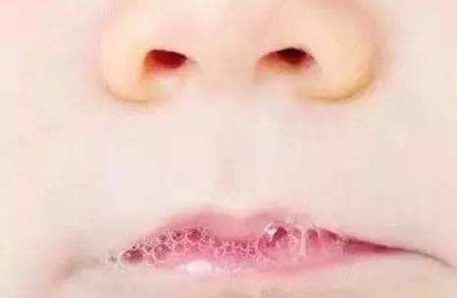 3个月大的宝宝爱吐泡泡就是肺炎更多的是宝宝成长的标志