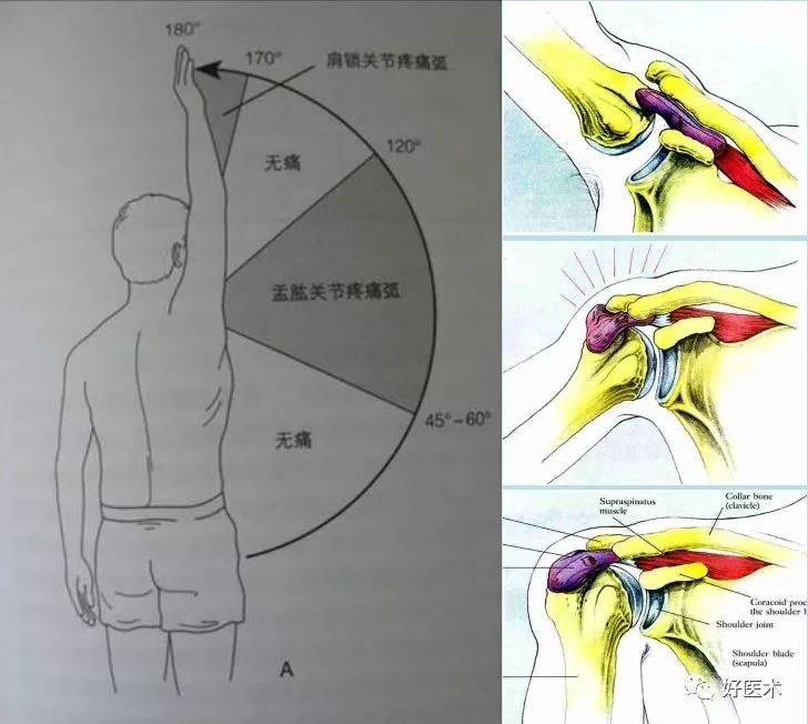 肩关节解剖动画图片