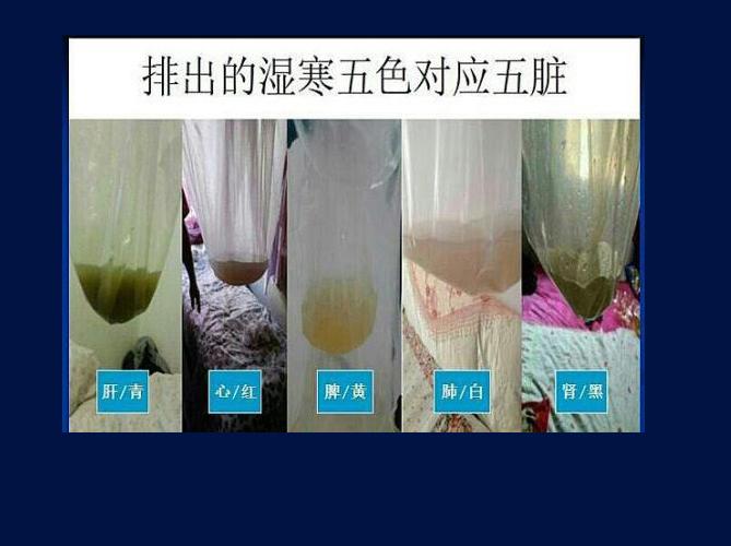 汗液颜色反应五脏