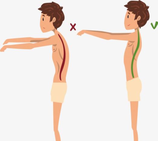 兒醫科普孩子姿勢不良會造成脊柱側彎嗎來聽聽專家怎麼說
