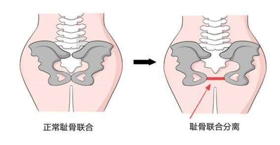 原创孕晚期疼痛到怀疑人生别着急医生教你来应对