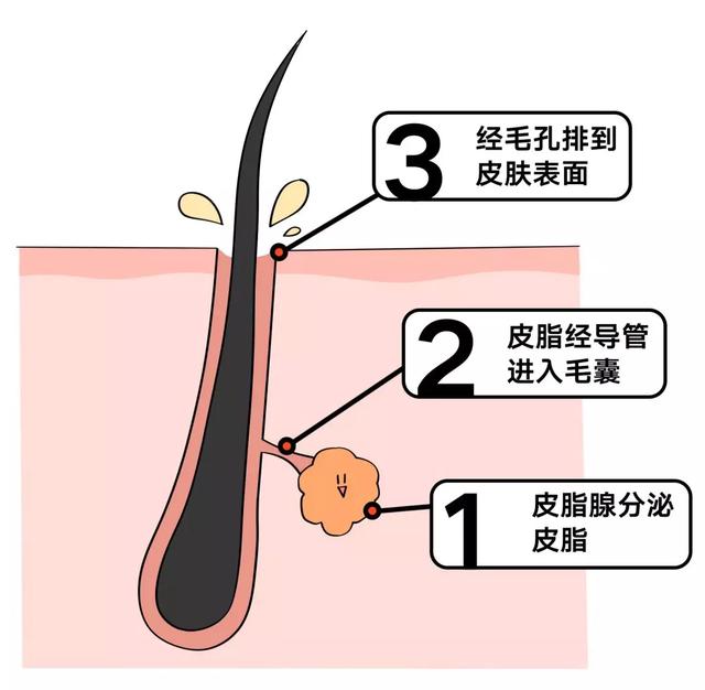在皮脂腺开工时,腺泡内的油脂,会通过导管进入毛囊,再经毛孔排到皮肤