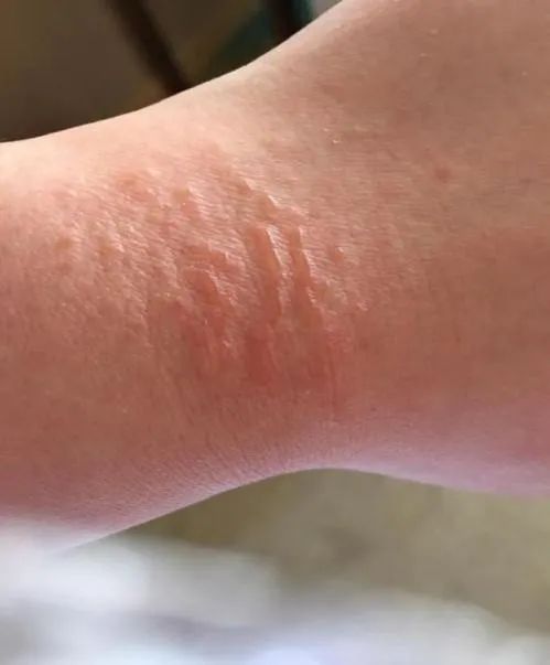 在洪山区洪山街隔离点14天24小时的守护日记守护中南大97