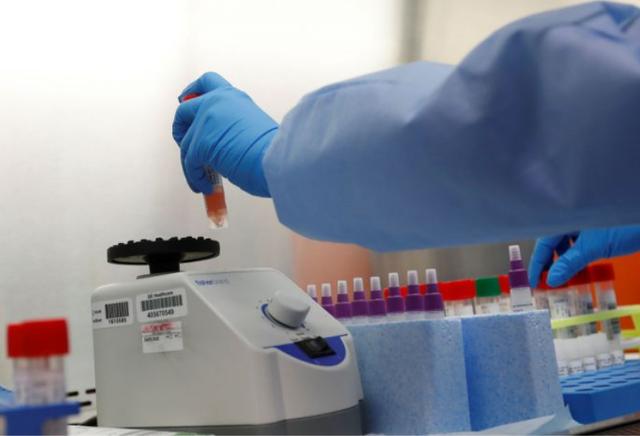 美国新冠检测能力惹人担忧,疾控中心三天才测77人