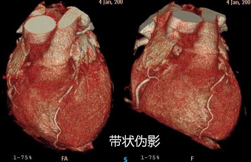 高清心血管疾病影像诊断你的收藏里怎能没有如此精品