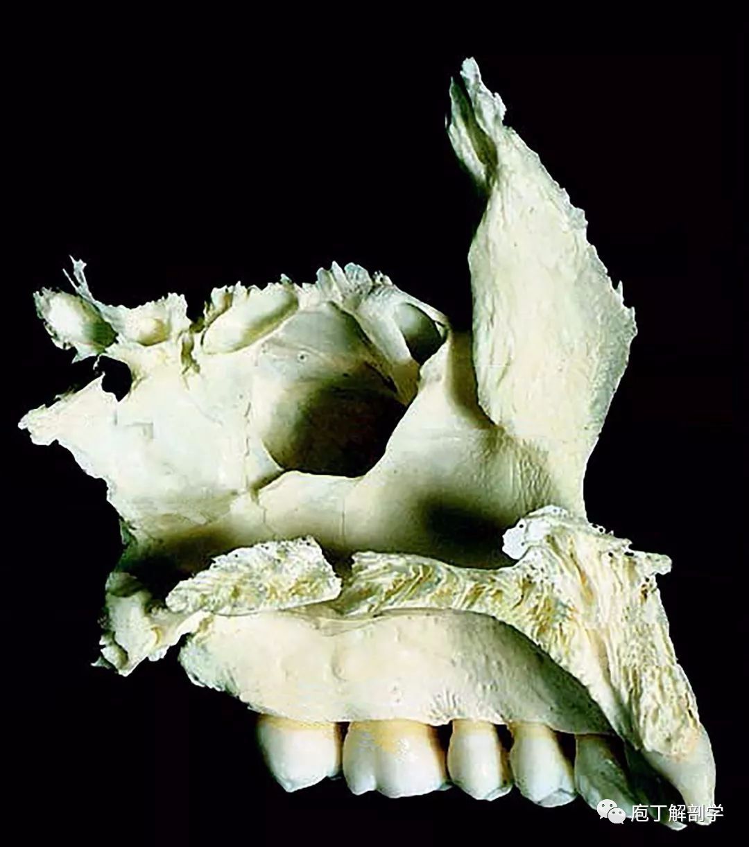 上颌骨的形态特点