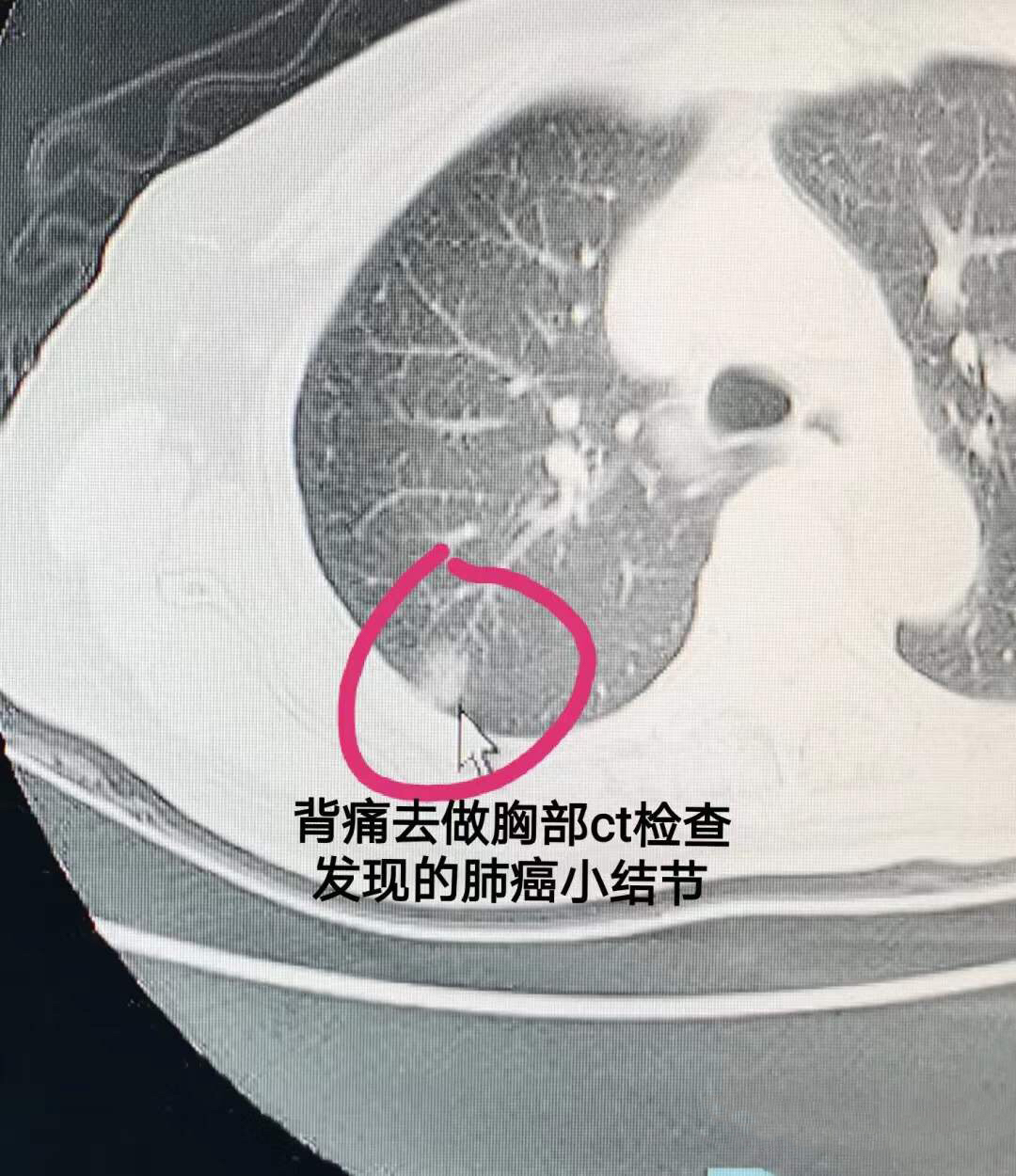 裁断済※胸部のCT 第4版 cutacut.com