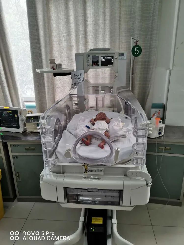 我院首例应用高频呼吸机成功抢救危重早产儿