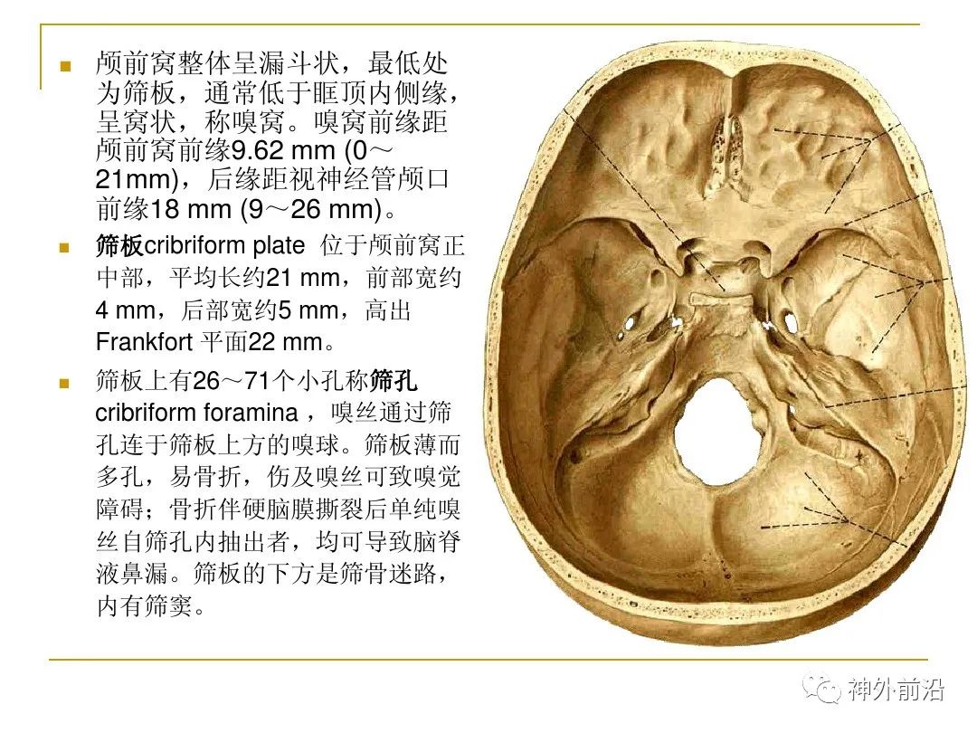 筛骨的筛孔图片