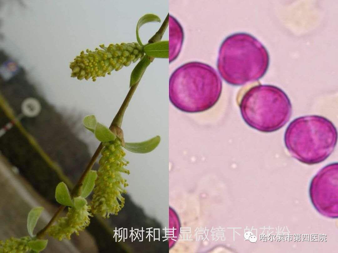 哈尔滨·3月15日花粉实况播报_市第四医院