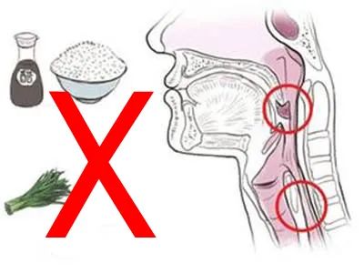 吃鲜鱼喉咙卡了鱼刺怎么办