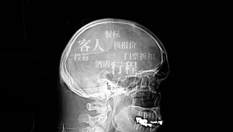 家人就带他到全市最好的医院做ct看完中医,这哥们觉得头疼的更厉害啦