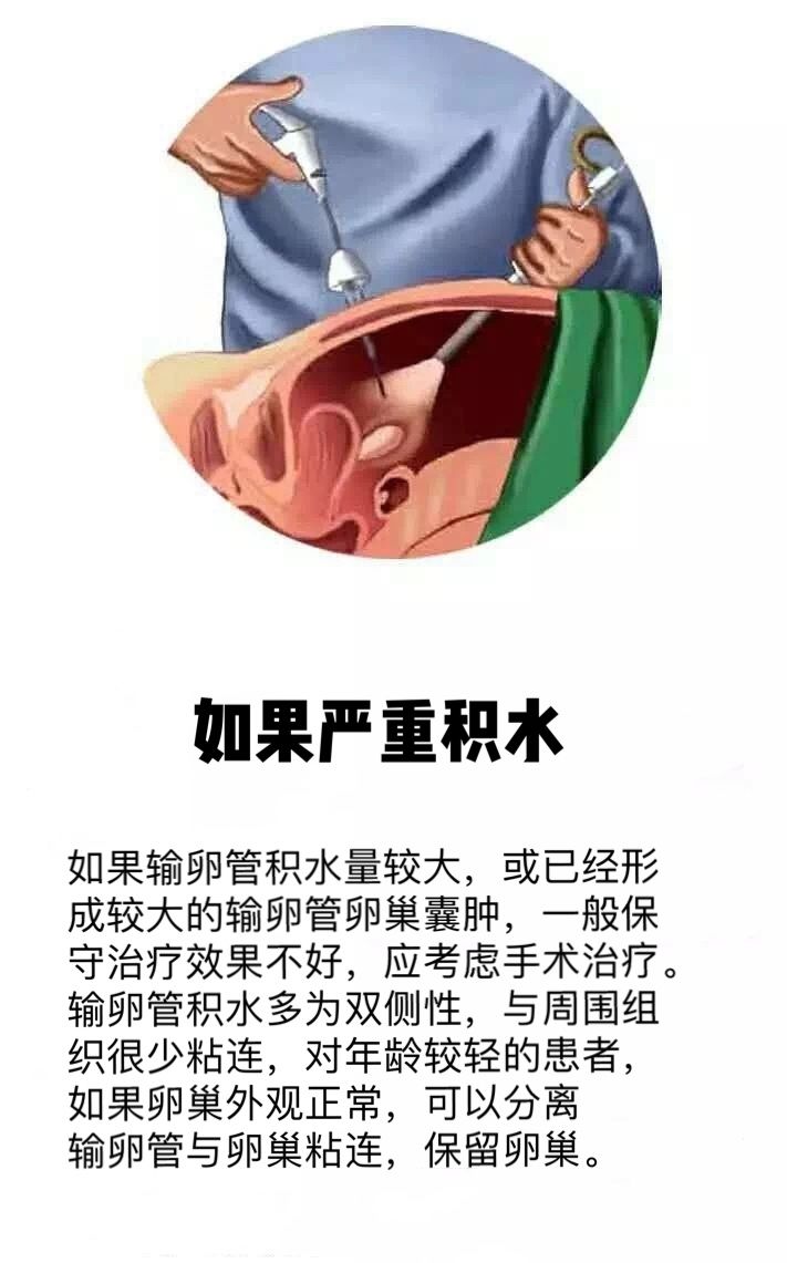 输卵管积水不可怕该如何科学备孕呢?