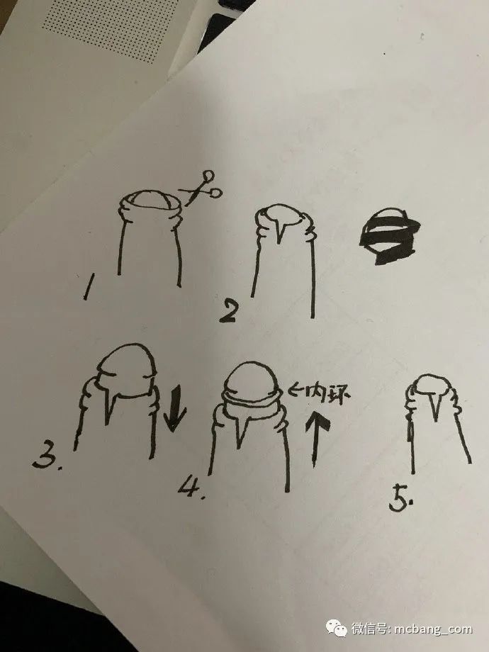 疫情能把人憋成什么样有人自己在家割包皮