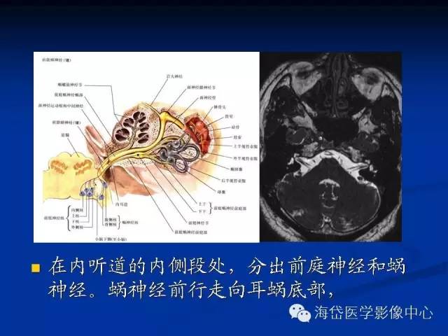 耳部ct及mri解剖