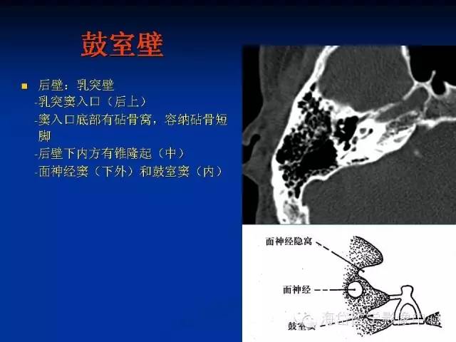 内耳ct解剖结构图图片