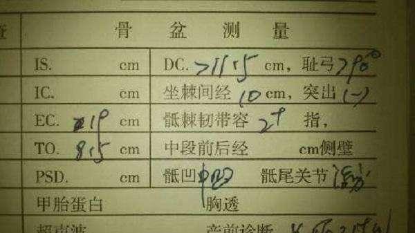 孕晚期最后一次产检,三个问题要问清楚,每个都关乎能否顺利分娩