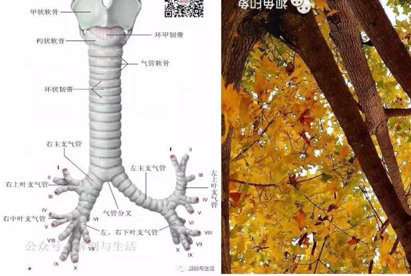 汇总新型冠状病毒肺炎covid19病例解析