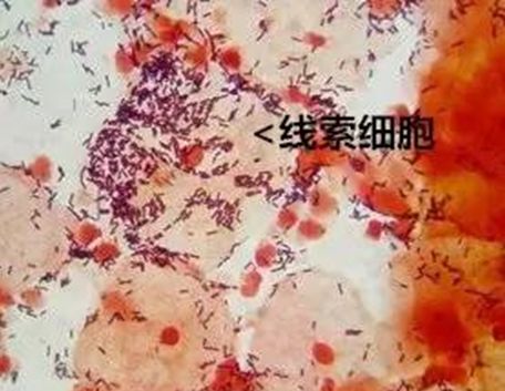 红细胞,白细胞,脓细胞,螺旋体,双球菌,滴虫,霉菌,阴道杆菌,闪光细胞