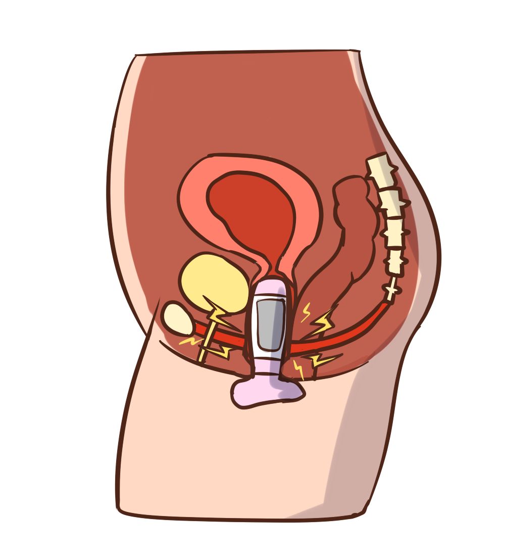 西安爱她365产后修复,盆肌底修复,来自盆底君的自白:我太委屈了_女性
