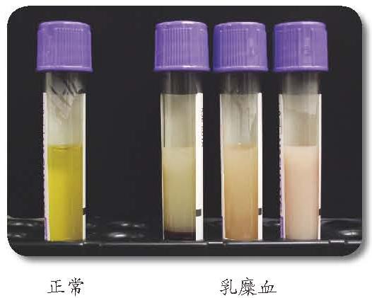 血管硬化会有3个身体变化,不要以为只是老了!