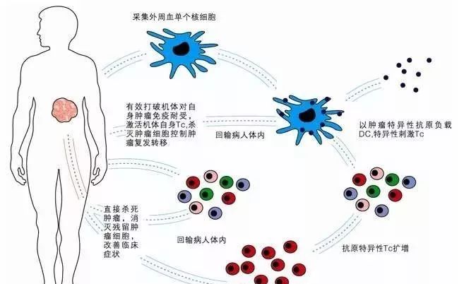 四,免疫細胞與衰老有關學者提出的免疫衰老學說認為免疫功能的衰退是