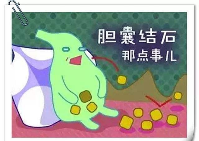 这四类人容易得胆囊炎,胆结石,如果你身上全有,那可要注意了-搜狐大视