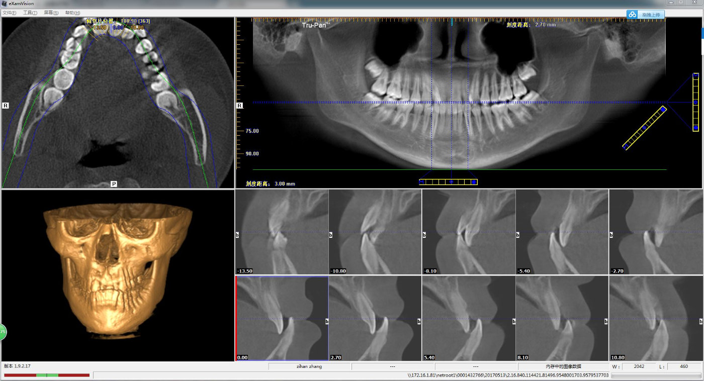 北京牙齿矫正杨磊什么是头影测量片什么是头影测量分析