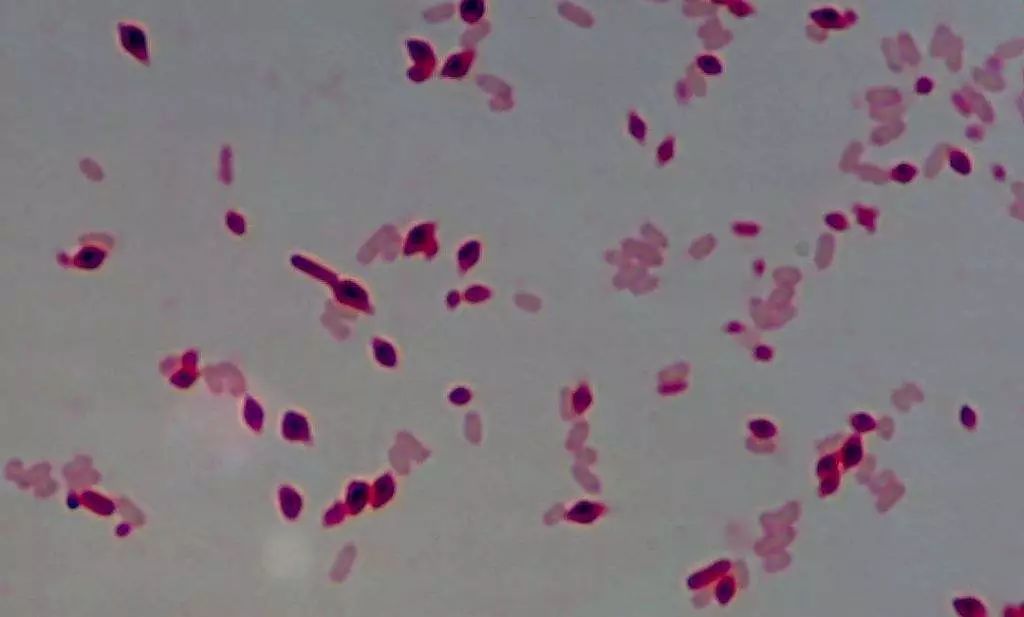 苏云金芽孢杆菌改善土壤微生态环境,促进团粒结构形成,改良土壤质地