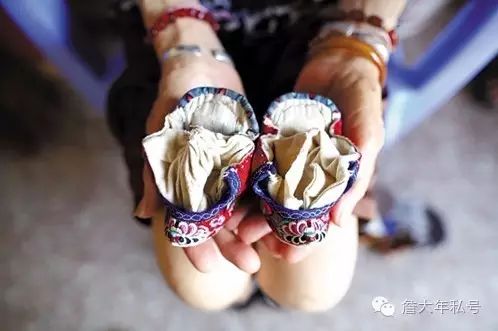 詹大年/从被裹脚的女人说起