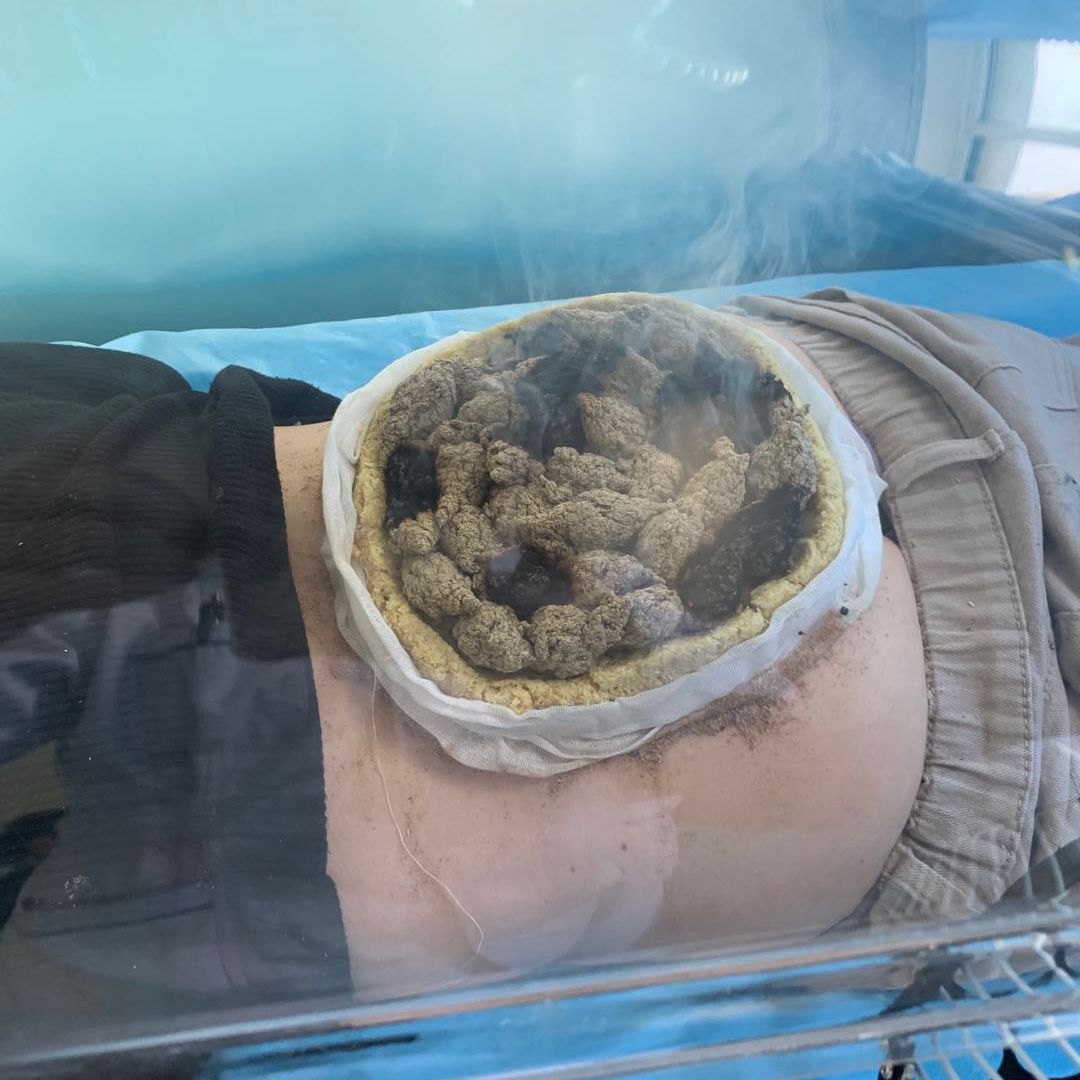 第一次到艾灸室的人们总是好奇这里为什么会有姜,蒜,盐和面团,其实