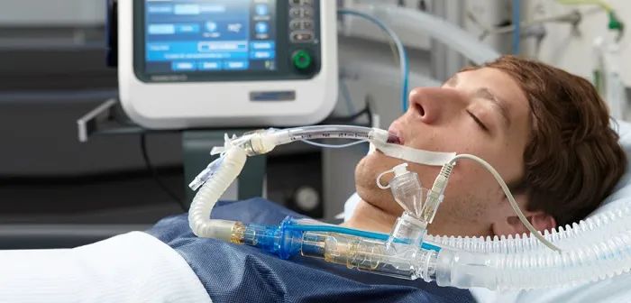 你也能用arduino制作开源呼吸机这家意大利医院还用3d打印阀门复活10