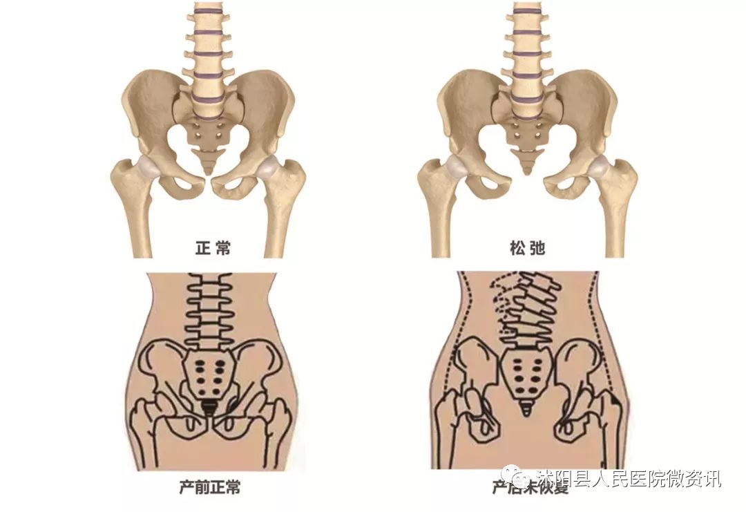 生过孩子的子宫 前后图片