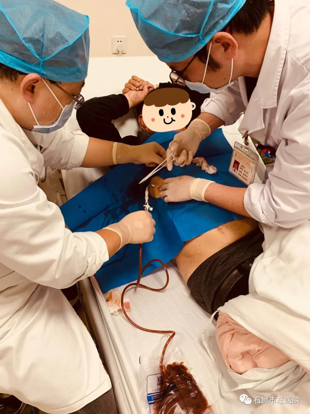 介入室成功为一名巨大肝脓肿患者实施了急诊超声介入下穿刺置管引流术